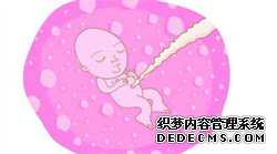 上海代生服务协议，瘢痕妊娠是个大手术吗